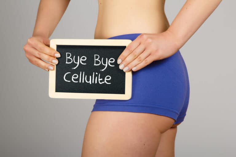Effective Ways to Address Cellulite