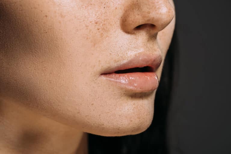 What is Lip Augmentation?