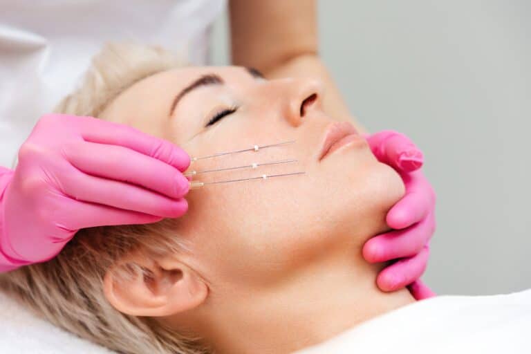 Thread Lift Newport Beach & OC